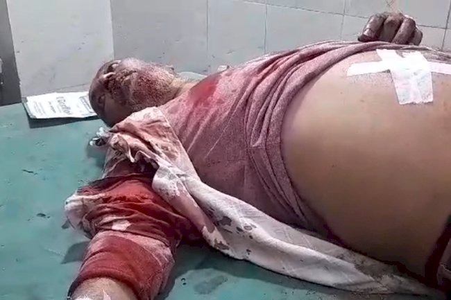 पेट्रोलपंप कर्मचारी को छुरा मार कर लाखो की लूट 