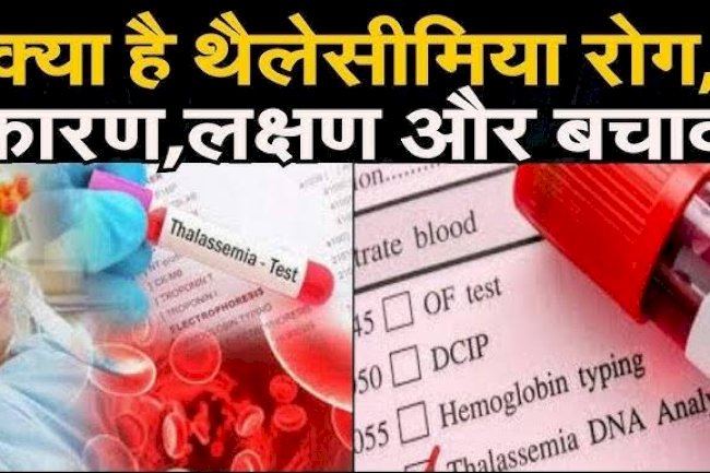 थैलीसीमिया उपचार और खर्च की वास्तविकता