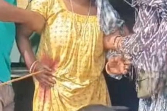 जमीन विवाद में भतीजी पर तीर से हमला